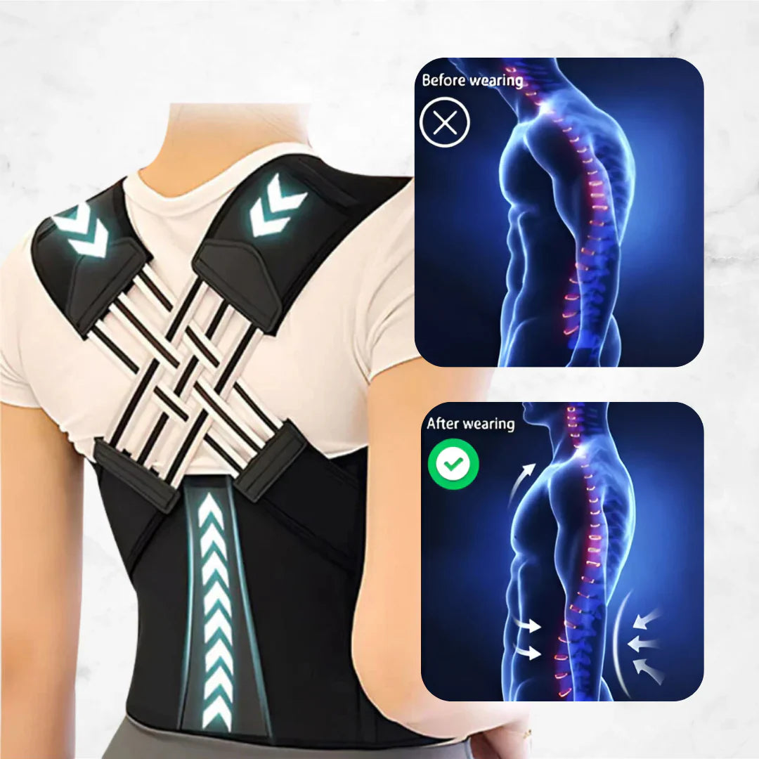 ALIGN PRO™ - Posture Corrector