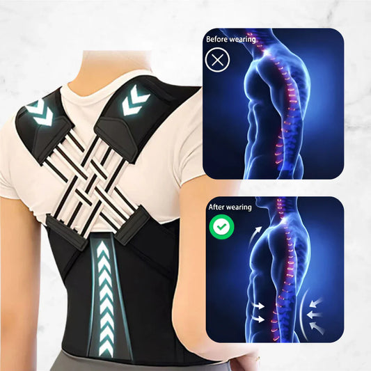 ALIGN PRO™ - Posture Corrector