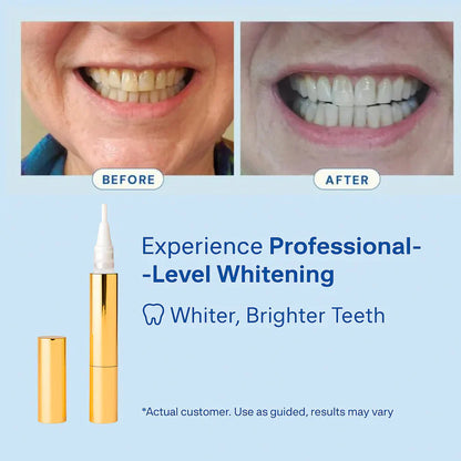 OralBright Pro™ Whitening Pen